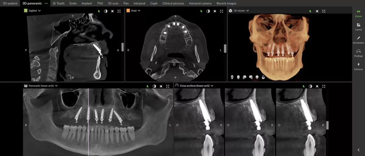 CBCT / OPT / X-ray | Cathedral Dental Clinic